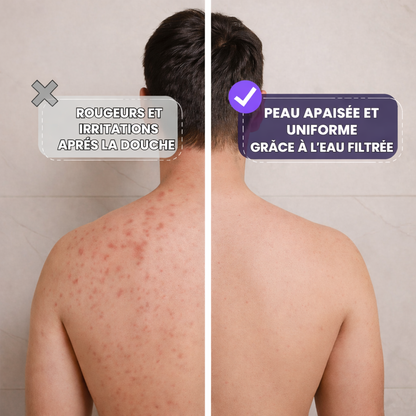 Ozorlo - pommeaux de douche anticalcaires